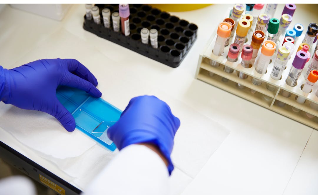 Researcher at work in a lab with equipment including vials and slides