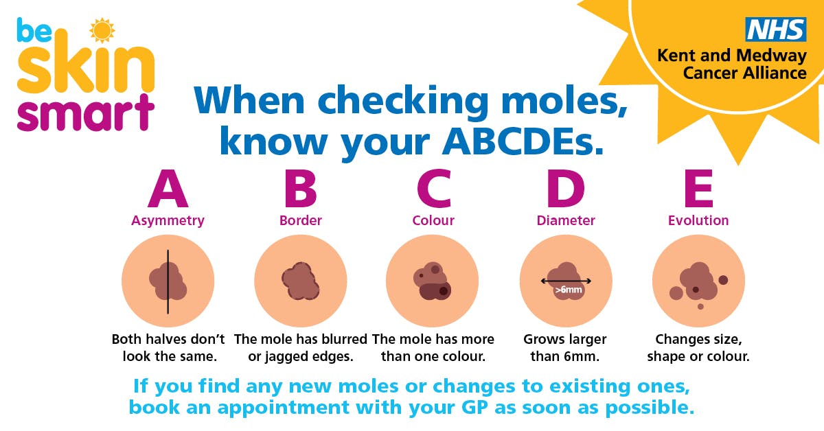 Poster showing five changes to moles to look out for.